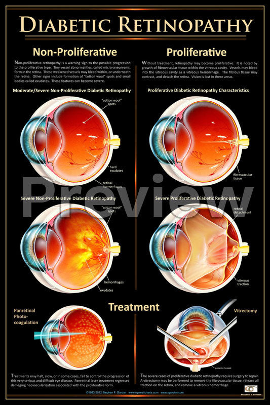 Diabetic Retinopathy Poster